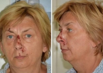 Mulher é encontrada ferida e sem memória em ilha na Croácia