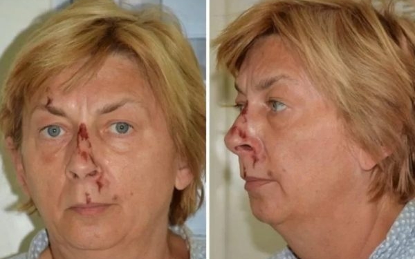 Mulher é encontrada ferida e sem memória em ilha na Croácia