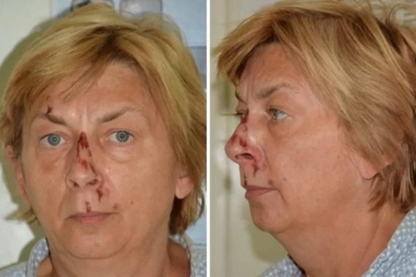 Mulher é encontrada ferida e sem memória em ilha na Croácia