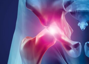 Lesão Labral:  O que existe de mais moderno no seu tratamento?