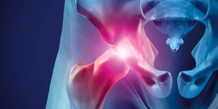 Lesão Labral:  O que existe de mais moderno no seu tratamento?