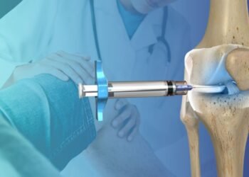 Como Funciona uma Infiltração no Joelho? Alívio Rápido para a Dor!