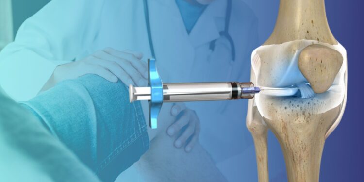 Como Funciona uma Infiltração no Joelho? Alívio Rápido para a Dor!