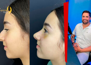 Espaço da Face: Excelência em Estética Facial com Dr. Rodrigo Bra