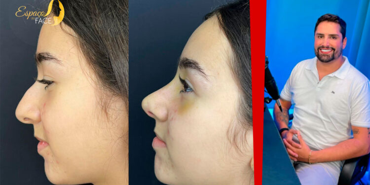 Espaço da Face: Excelência em Estética Facial com Dr. Rodrigo Bra