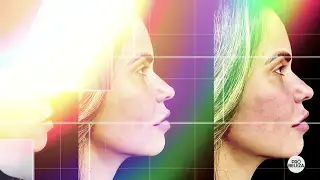 Dr. Rodrigo Revela Segredos da Harmonização Orofacial