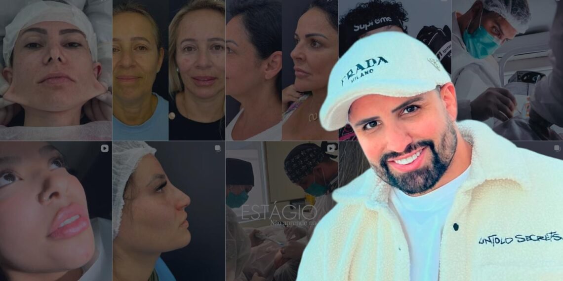 Minilifting se torna a cirurgia mais desejada pelas mulheres, afirma Dr. Rodrigo Soares.