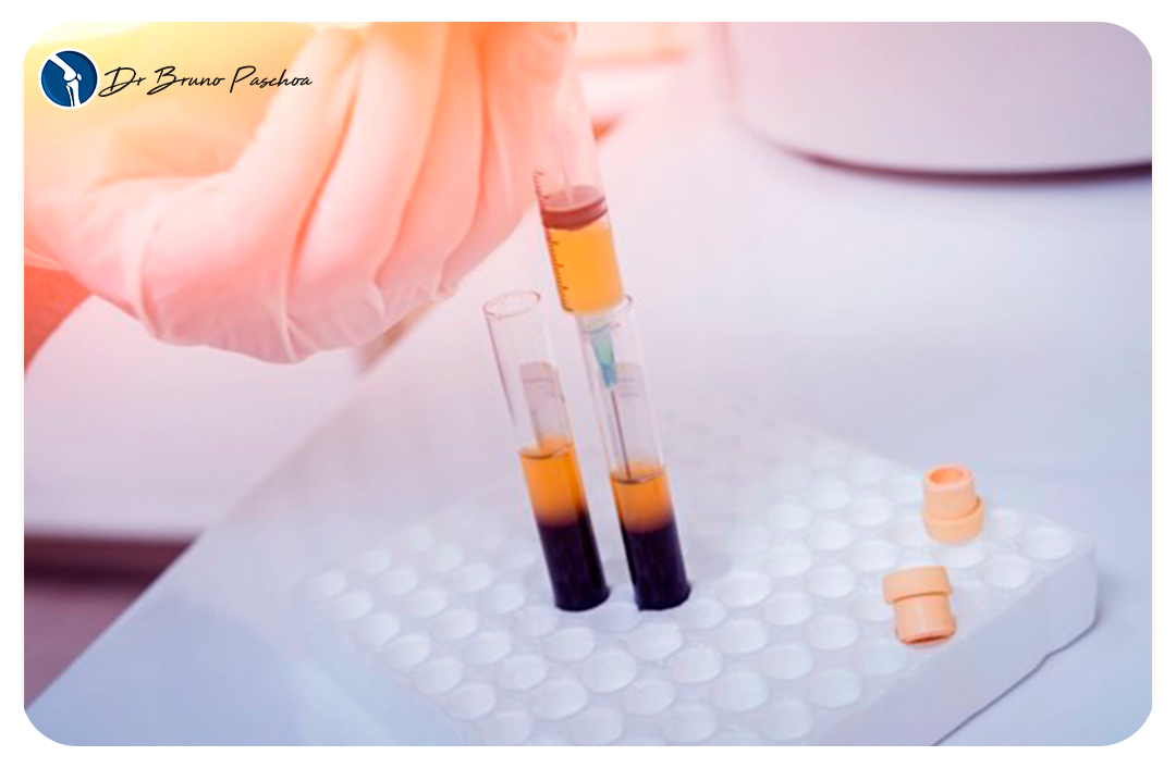 Tubos para processamento de medicina regenerativa