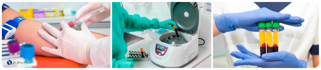 Preparação de terapias biológicas e plasma rico em plaquetas (PRP)